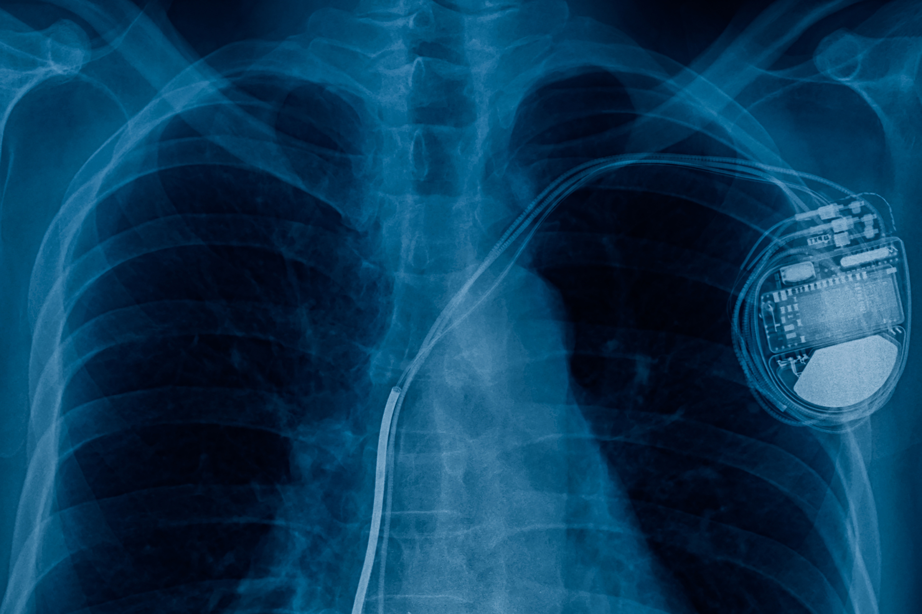 x-ray